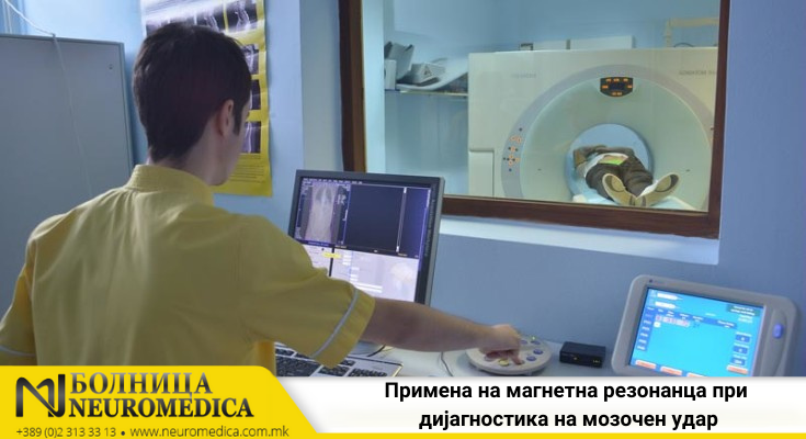 Магнетната резонанца – златен стандард за утврдување на мозочен удар.